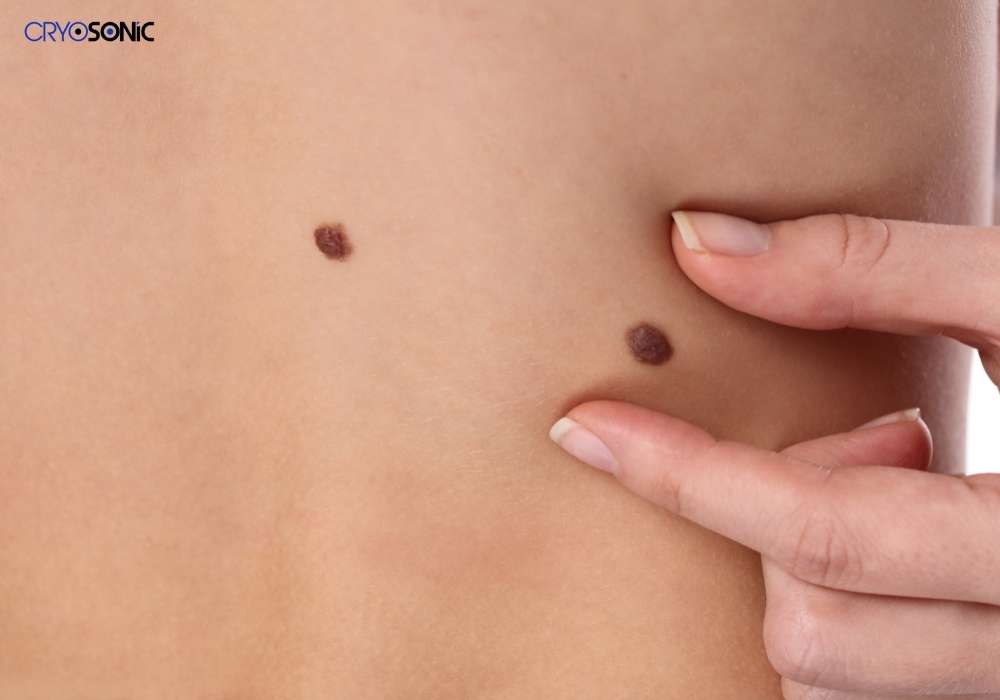 Infection Risk and Poor Aftercare Sheffield