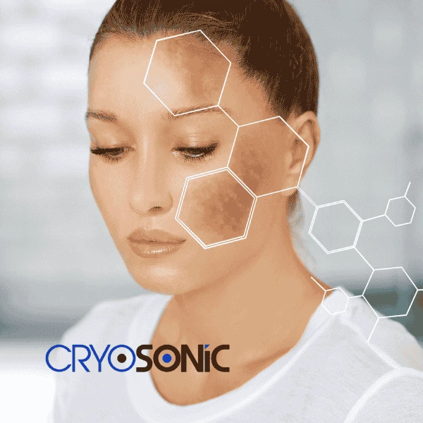 Are you looking for age spot removal treatment? Contact Cryosonic today in Sheffield