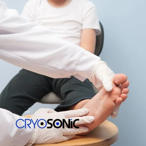 Are you looking for fast effective wart removal Contact us today Sheffield