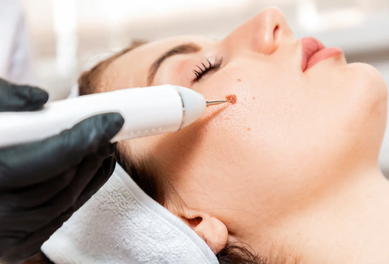 Frequently Asked Questions About Multiple Cryotherapy Treatments Sheffield