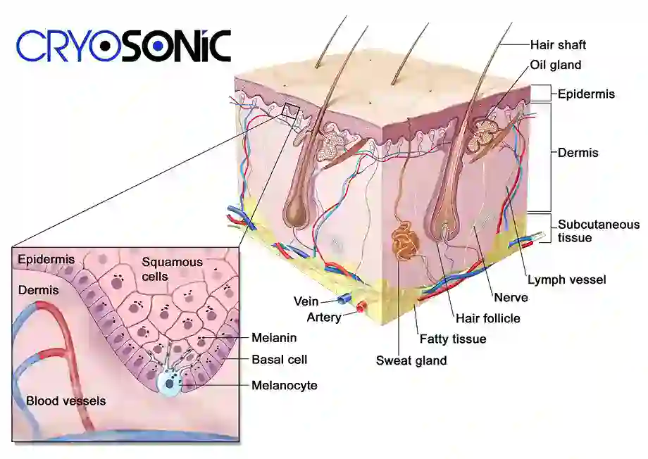 How Cryotherapy Stimulates Melanocyte Activity Sheffield